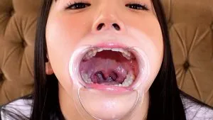 雅子りな口内接写,開口器,顔面接写