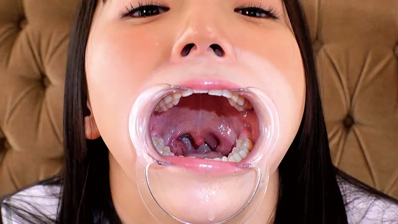 雅子りな口内接写,開口器,顔面接写